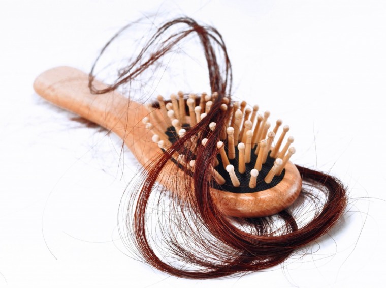 Какие привычки способствуют выпадению волос