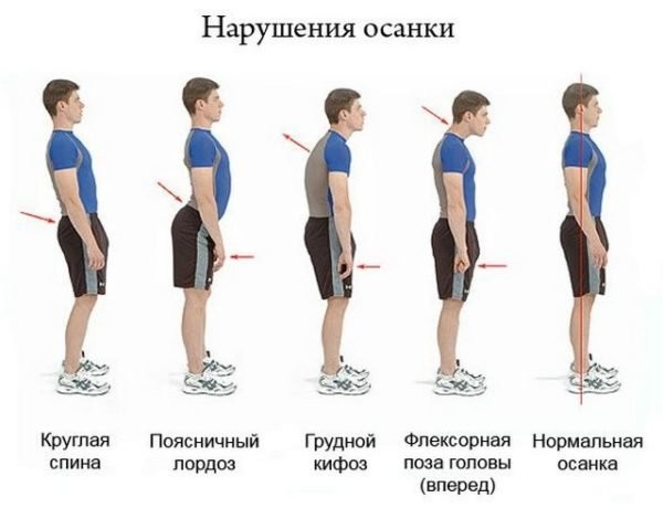 Как добиться королевской осанки Как добиться королевской осанки