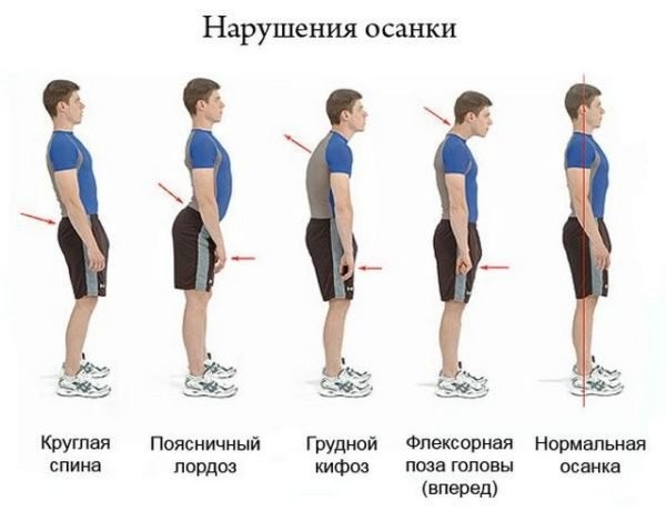 ​Как добиться королевской осанки