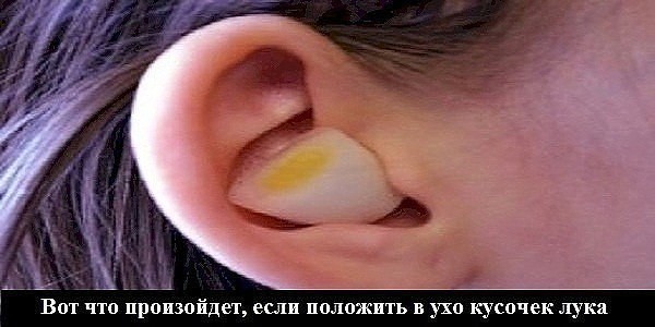 Вот что произойдет, если положить в ухо кусочек лука! Вот что произойдет, если положить в ухо кусочек лука!
