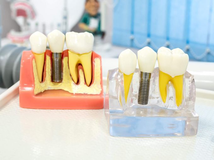 зубные щетки для зубных коронок