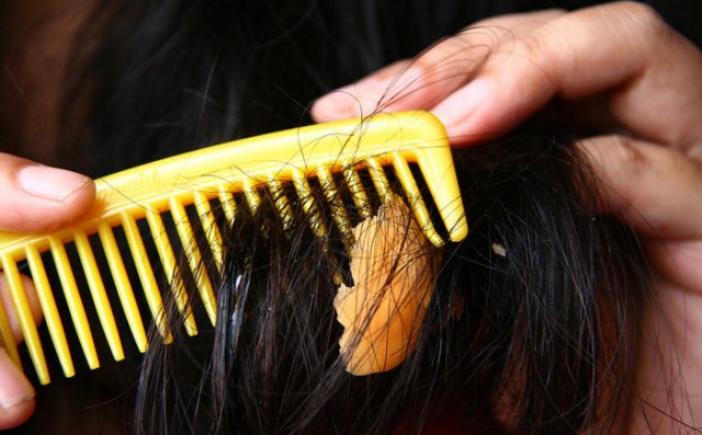 Как удалить жвачку из волос?
