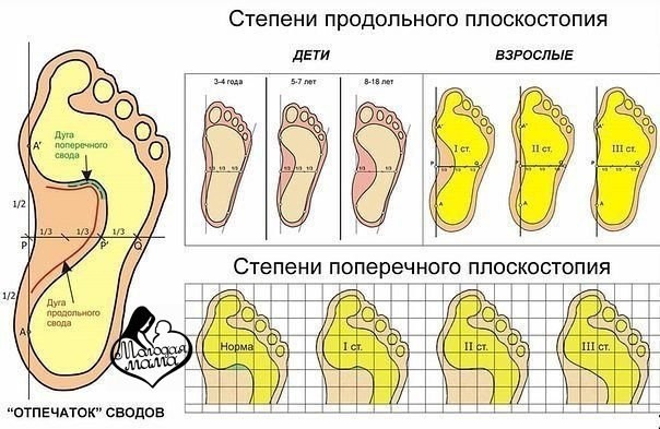 ​Бесценные упражнения для детских стоп