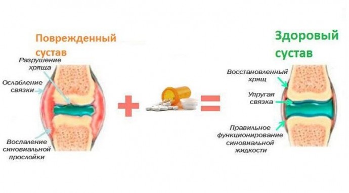 Регенерация хряща: лучшие продукты для активизации процесса