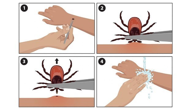 ​Если вас укусил клещ