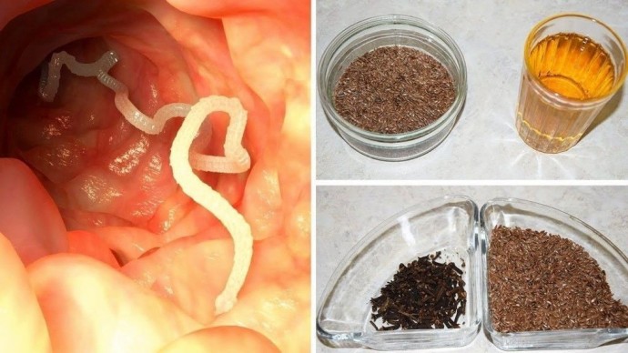 ​2 сильных ингредиента, которые очистят ваш организм от паразитов и уменьшат отложения жиров