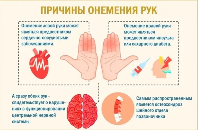 Что важно знать о том, почему немеют пальцы рук Что важно знать о том, почему немеют пальцы рук
