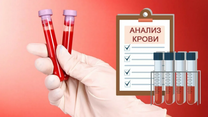 9 показателей крови, которые расскажут всё о вашем здоровье 9 показателей крови, которые расскажут всё о вашем здоровье