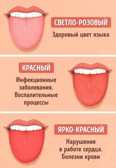 12 проблем, о которых может рассказать цвет языка