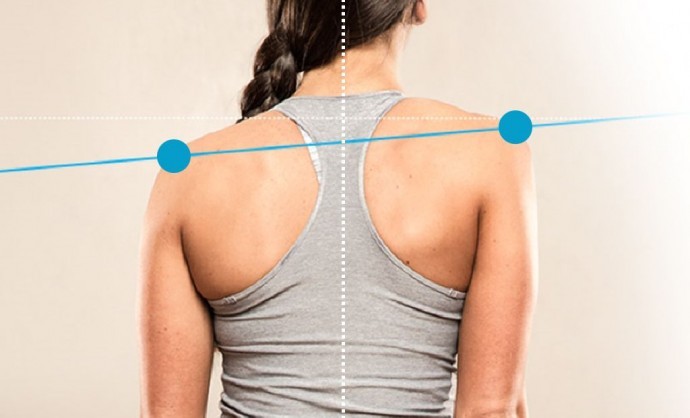 ​Избегаем перекоса таза