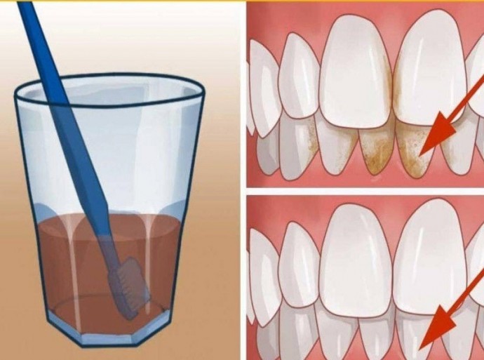 ​Превосходный способ очищения от зубного камня прямо у себя дома