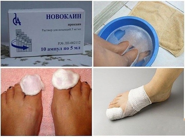 Убираем грибок на ногтях Убираем грибок на ногтях