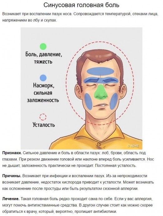 5 типов головной боли и способы быстро от них избавиться