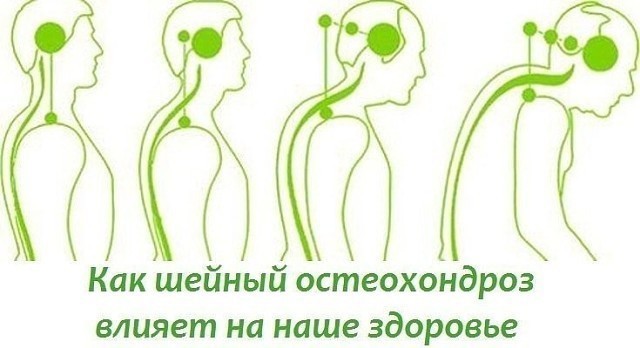 Эти упражнения улучшают кровоснабжение мозга, выпрямляют позвоночник, освобождает сосуды от зажимов Эти упражнения улучшают кровоснабжение мозга, выпрямляют позвоночник, освобождает сосуды от зажимов