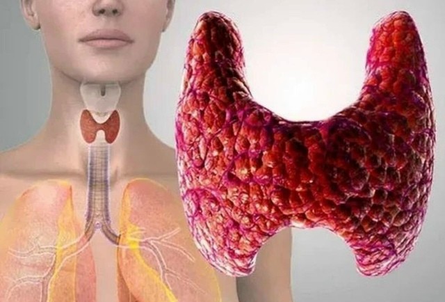 Три продукта, чтобы поддержать щитовидку Три продукта, чтобы поддержать щитовидку