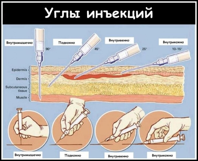 ​Как правильно делать уколы