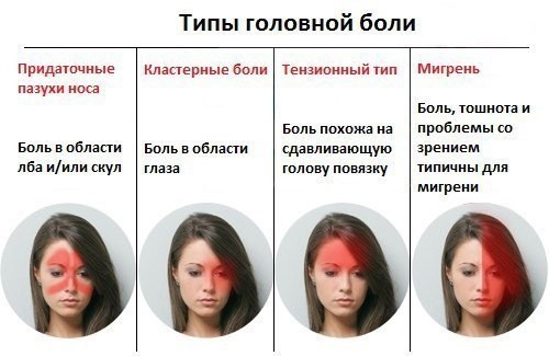 Что делать с головной болью Что делать с головной болью