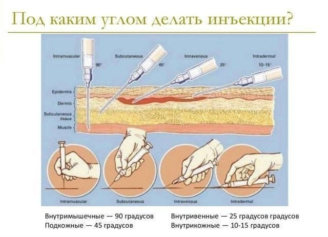 Как правильно делать инъекции