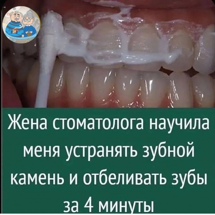 Как отбелить зубы и не нанести им вреда