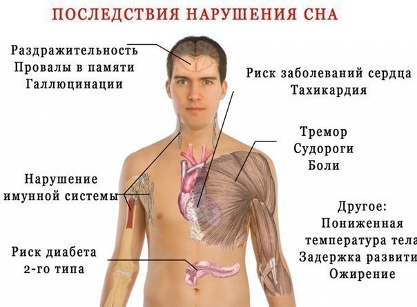 Почему важно спать достаточно или ​8 последствий нарушения сна