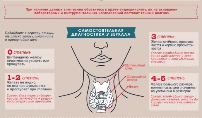 Симптому гипотиреоза и гипертиреоза Симптому гипотиреоза и гипертиреоза