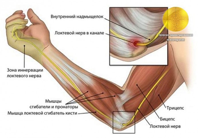 ​Синдром сдавливания локтевого нерва