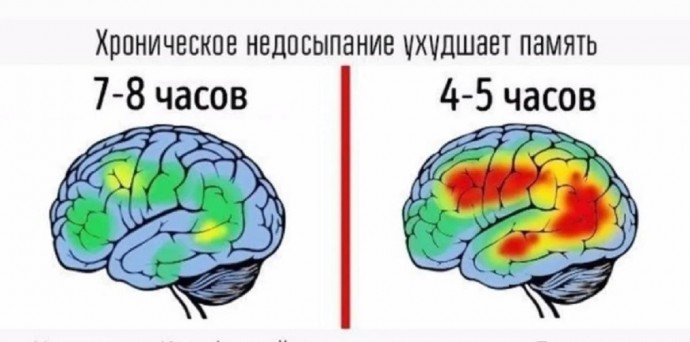 Почему возникает хроническое недосыпание Почему возникает хроническое недосыпание