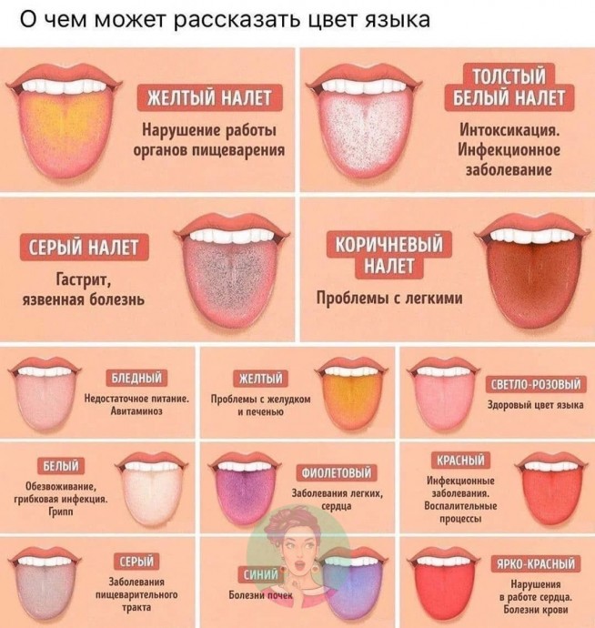 Что можно определить по цвету языка