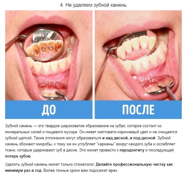 ​8 ошибок в уходе за зубами, которые совершает каждый из нас