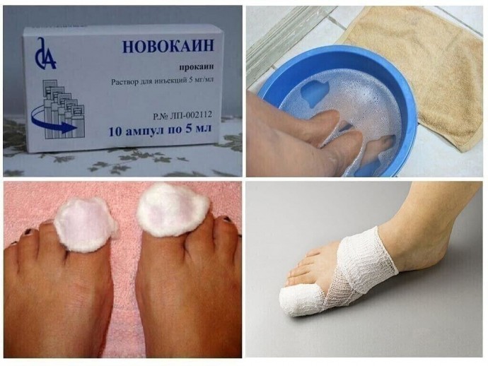 Профилактика грибка на ногтях рук и ног Профилактика грибка на ногтях рук и ног