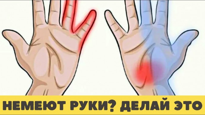 Если у вас немеют руки Если у вас немеют руки