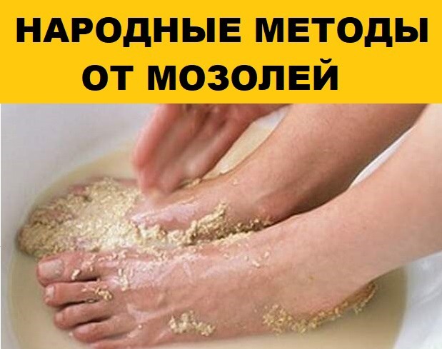 Народные методы от мозолей