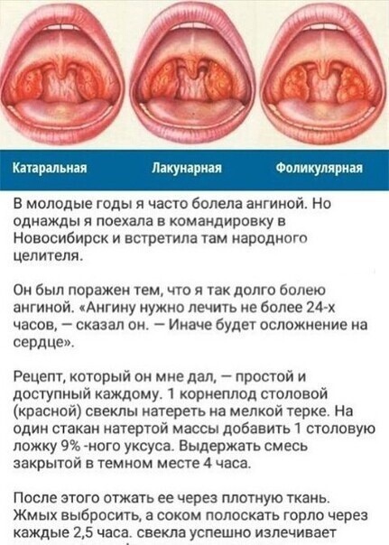 Экологичный способ лечения воспалений горла Экологичный способ лечения воспалений горла