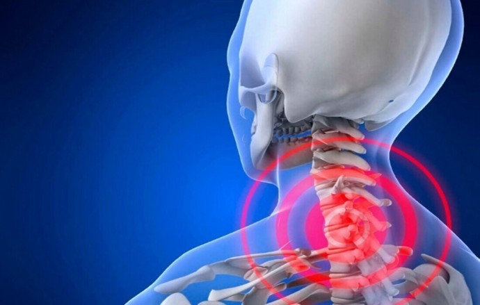 ​8 упражнений против шейного остеохондроза