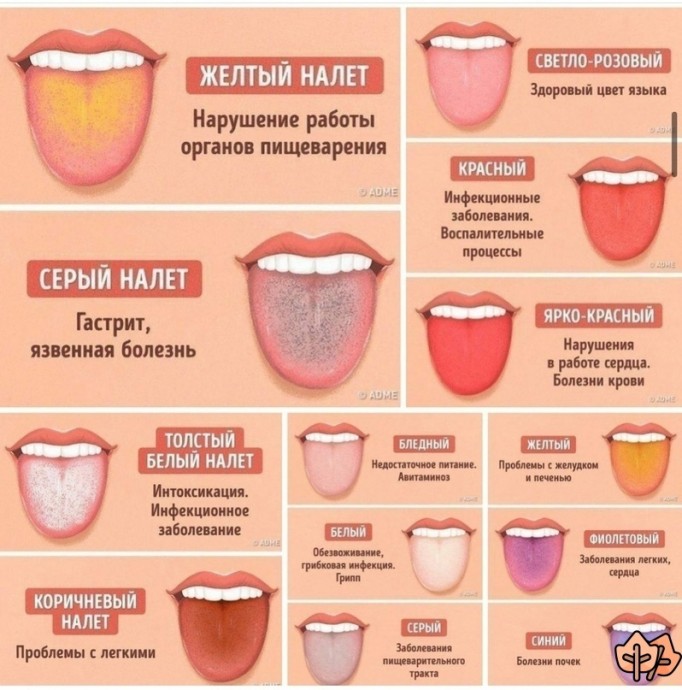 О чем же может рассказать цвет языка и налет на нем