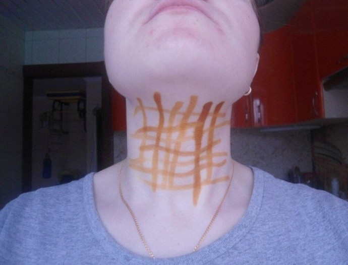 ​Йодная сетка: проблемы, которые она способна решить