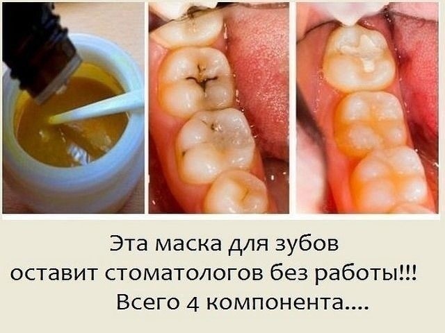 Маска для зубов Маска для зубов