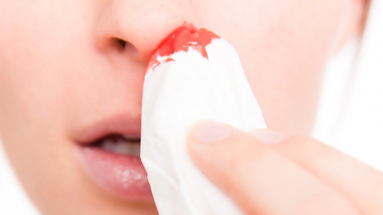 ​Как остановить кровь из носа