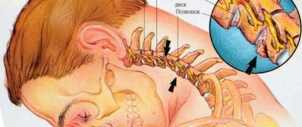 Если у вас болит шея. Если у вас болит шея.