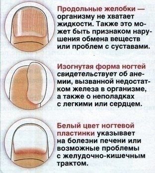 О чем может сказать ноготь